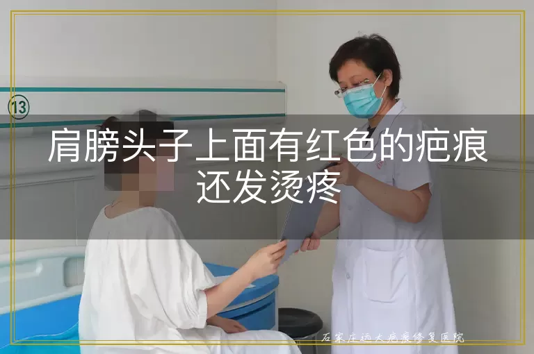肩膀头子上面有红色的疤痕还发烫疼