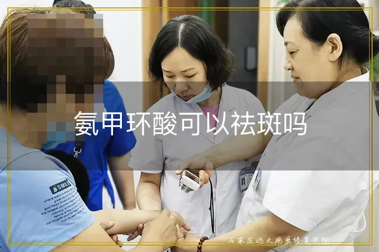 氨甲环酸可以祛斑吗