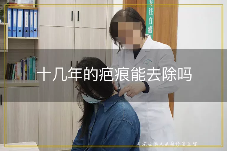 十几年的疤痕能去除吗