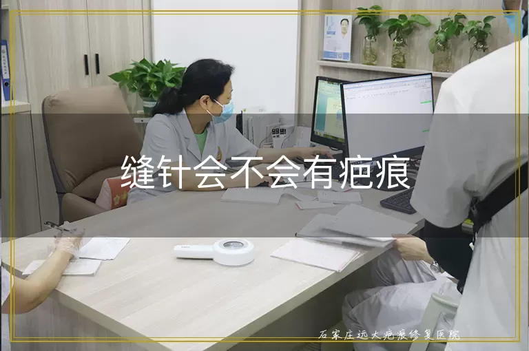 缝针会不会有疤痕