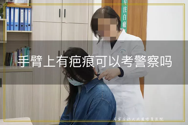手臂上有疤痕可以考警察吗