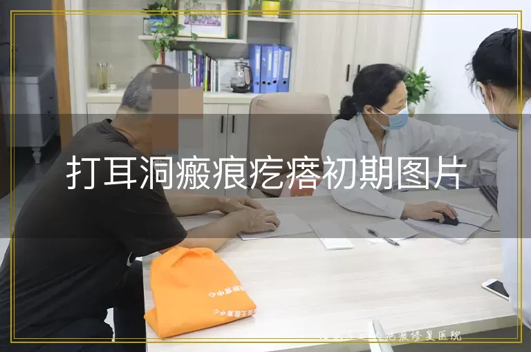 打耳洞瘢痕疙瘩初期图片