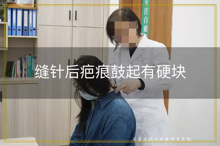缝针后疤痕鼓起有硬块
