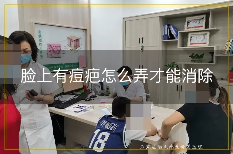 脸上有痘疤怎么弄才能消除
