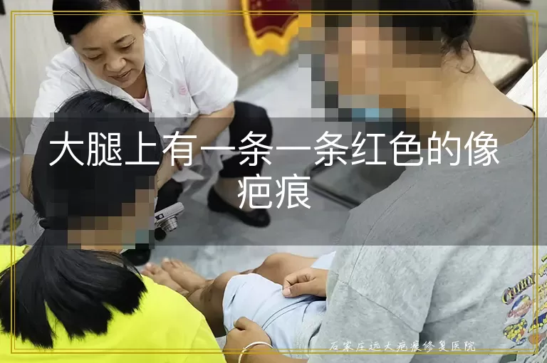 大腿上有一条一条红色的像疤痕