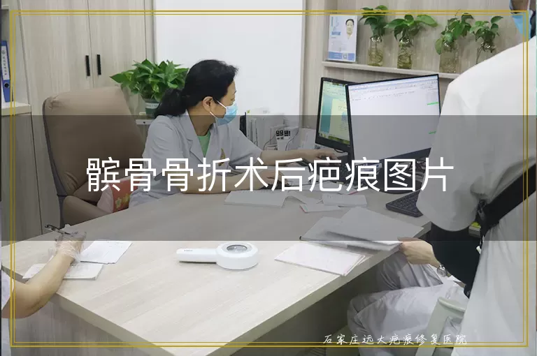 髌骨骨折术后疤痕图片