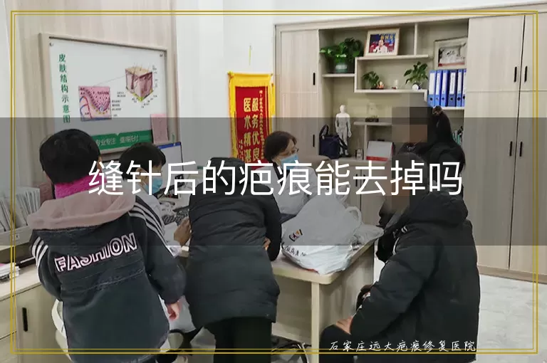 缝针后的疤痕能去掉吗