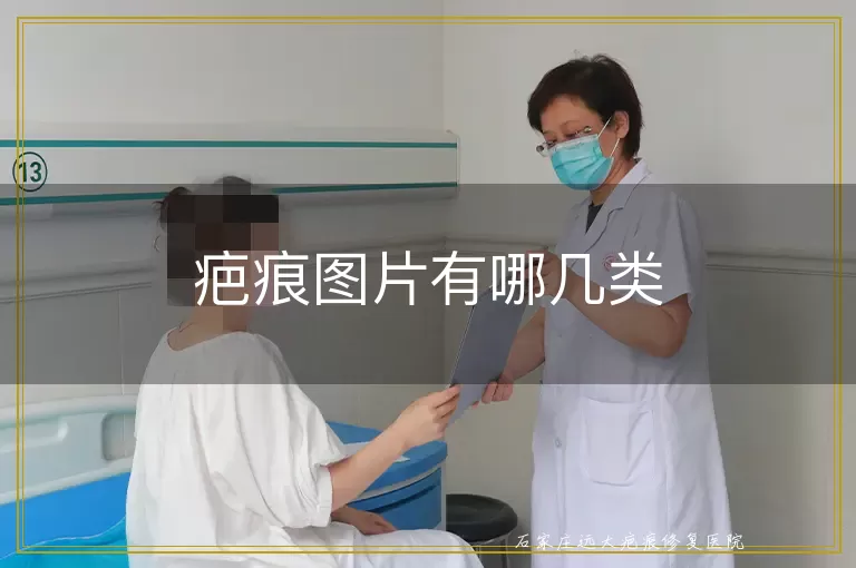 疤痕图片有哪几类