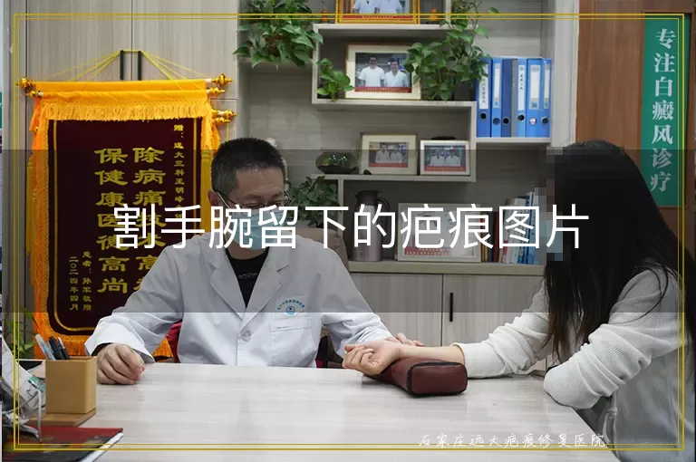 割手腕留下的疤痕图片