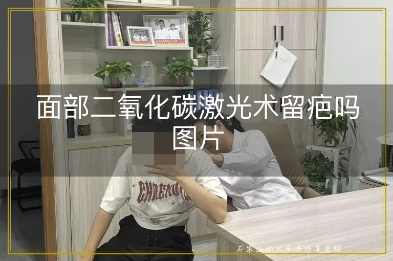 面部二氧化碳激光术留疤吗图片