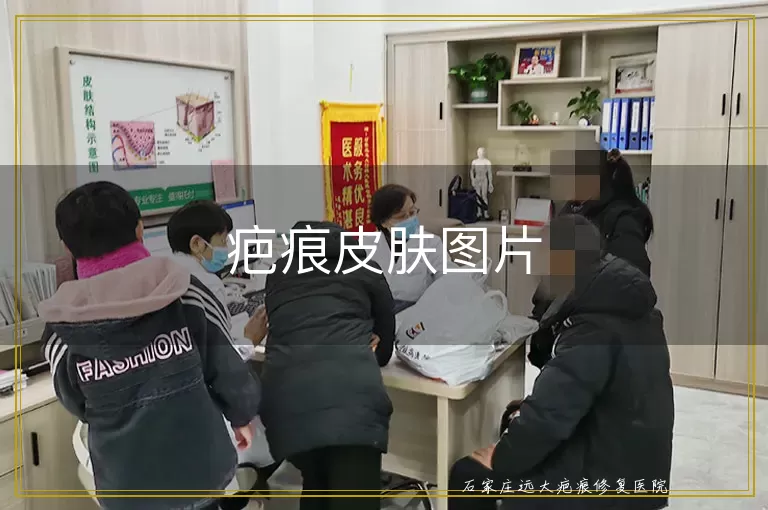 疤痕皮肤图片