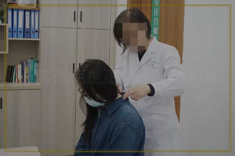 欣奕除疤是正规的吗安全吗