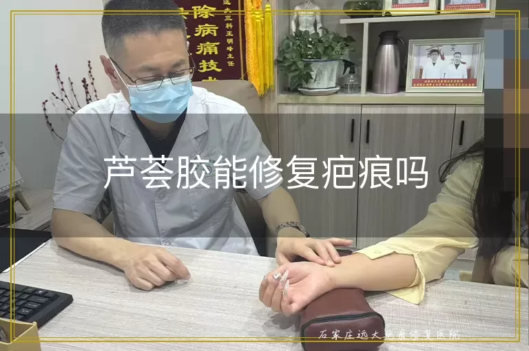 芦荟胶能修复疤痕吗