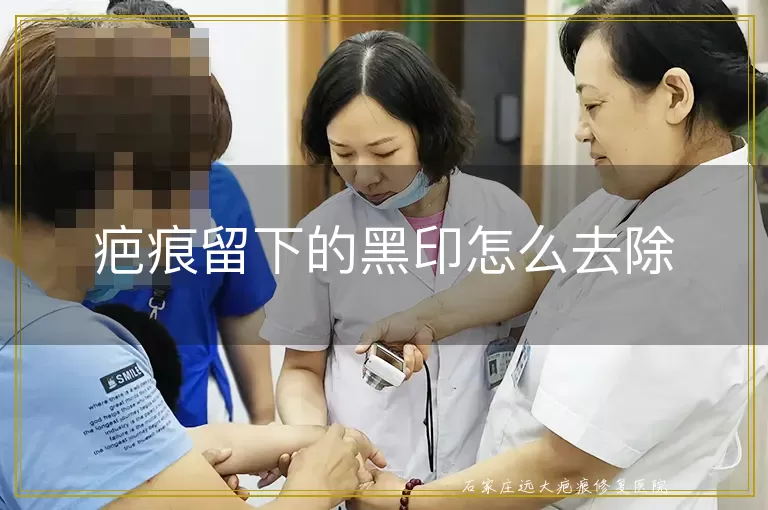 疤痕留下的黑印怎么去除