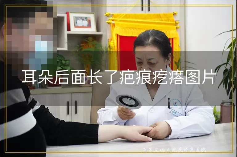 耳朵后面长了疤痕疙瘩图片