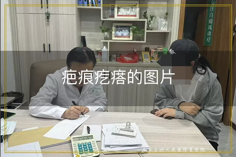 疤痕疙瘩的图片