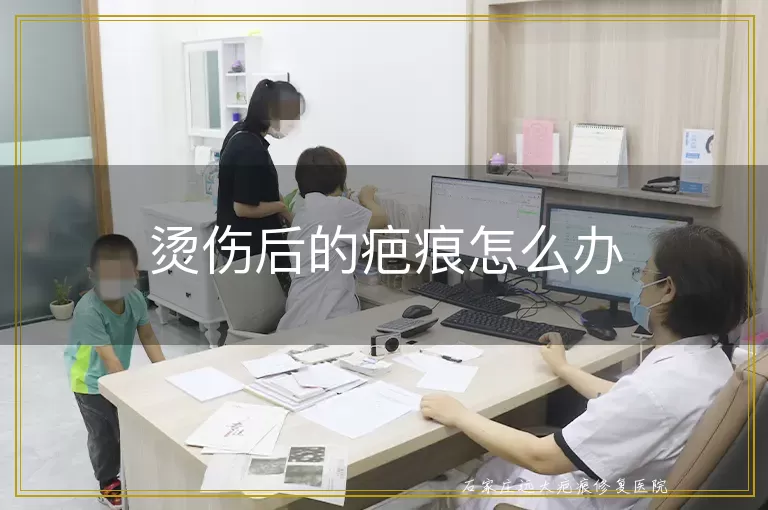 烫伤后的疤痕怎么办