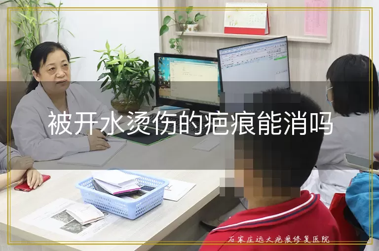 被开水烫伤的疤痕能消吗