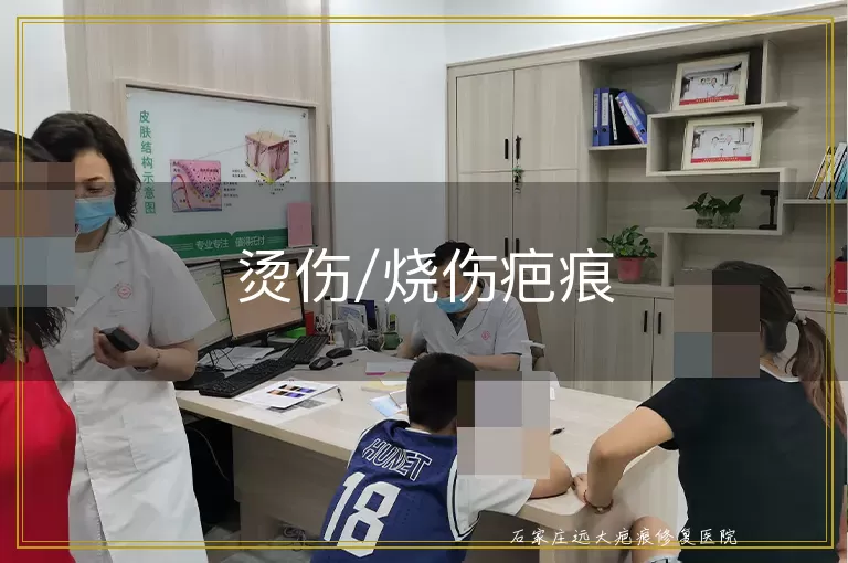烫伤/烧伤疤痕