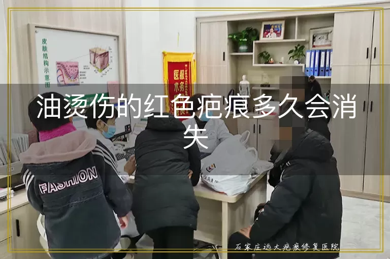 油烫伤的红色疤痕多久会消失