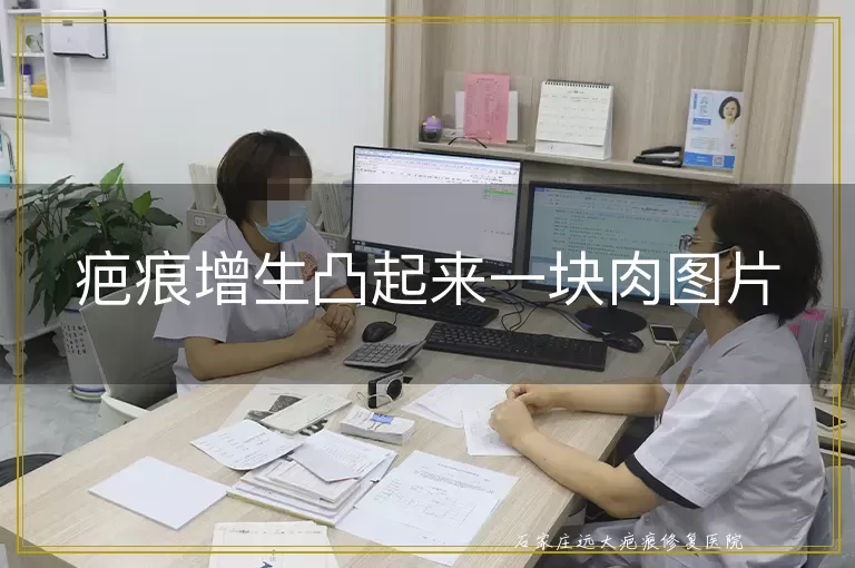 疤痕增生凸起来一块肉图片